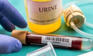 Urine Test
